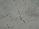 Lasiosphaeria strigosa image