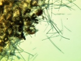 Thielaviopsis basicola image