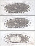 Pertusaria heterochroa image