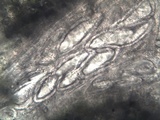 Pertusaria hymenea image