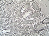 Pertusaria hymenea image