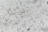 Cryptococcus macerans image