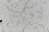 Cryptococcus macerans image