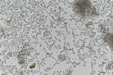 Cryptococcus macerans image