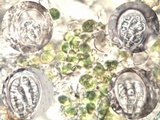 Arthonia radiata image