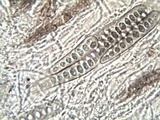 Phaeographis dendritica image