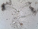 Phlyctis agelaea image
