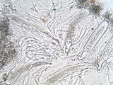 Phlyctis agelaea image