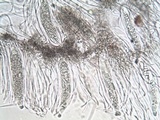 Phlyctis agelaea image