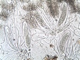 Phlyctis agelaea image
