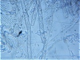 Plectania rhytidia image