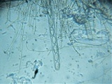 Plectania rhytidia image