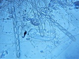 Plectania rhytidia image
