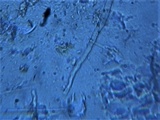 Plectania rhytidia image