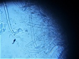Plectania rhytidia image
