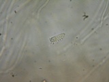 Heterotextus luteus image