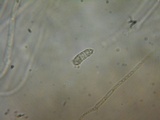 Heterotextus luteus image