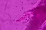 Gloniopsis subrugosa image