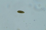 Gloniopsis subrugosa image