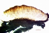 Trapelia coarctata image