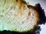 Trapelia coarctata image