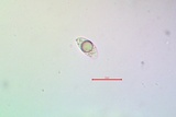 Trapelia coarctata image