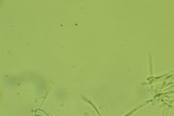 Arachnopeziza trabinelloides image