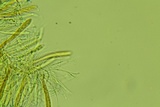 Arachnopeziza trabinelloides image