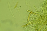 Arachnopeziza trabinelloides image