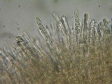 Lachnellula calyciformis image