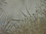 Lachnellula calyciformis image