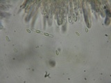 Lachnellula calyciformis image