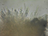 Lachnellula calyciformis image