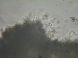 Trechispora farinacea image