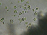 Trechispora farinacea image