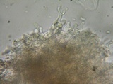 Galzinia pedicellata image