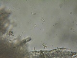 Galzinia pedicellata image