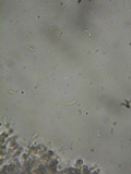 Galzinia pedicellata image
