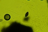 Rosellinia corticium image