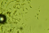 Diatrype virescens image