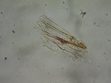 Inocephalus cystomarginatus image