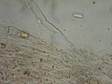 Inocephalus cystomarginatus image