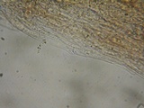 Inocephalus cystomarginatus image