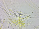 Stamnaria americana image