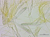Stamnaria americana image