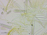 Stamnaria americana image