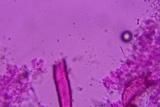 Athelia binucleospora image