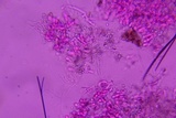 Athelia binucleospora image
