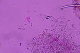 Athelia binucleospora image