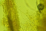 Sistotrema porulosum image